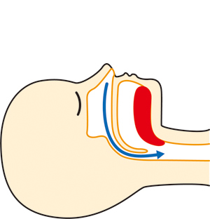 睡眠時無呼吸症候群