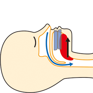 睡眠時無呼吸症候群